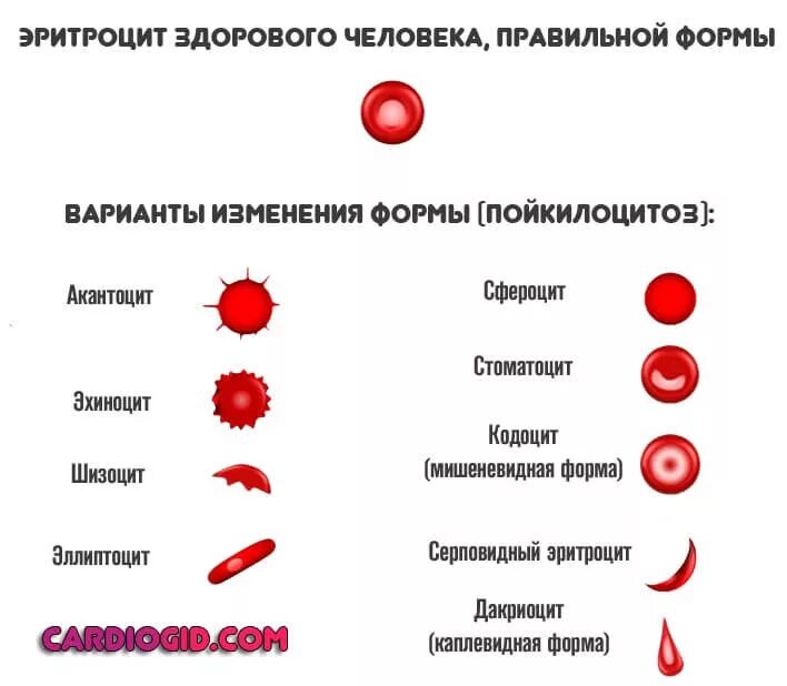 Аллергическая анемия. Пойкилоцитоз формы эритроцитов. Изменение формы эритроцитов (пойкилоцитоз). Патологические формы эритроцитов пойкилоцитоз. Патологические изменения эритроцитов при анемии.