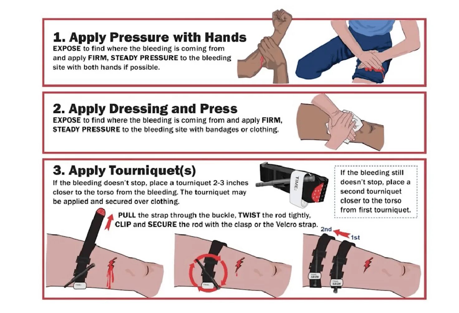 Doesn t apply. How to stop Bleeding first Aid.