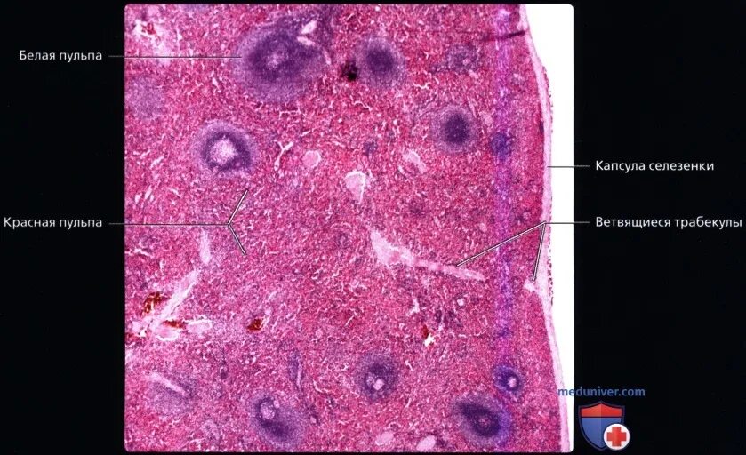 Селезенка гистология препарат. Лимфоидный фолликул селезенки гистология. Красная пульпа селезенки гистология. Строение селезенки гистология. Стволовые клетки селезенки