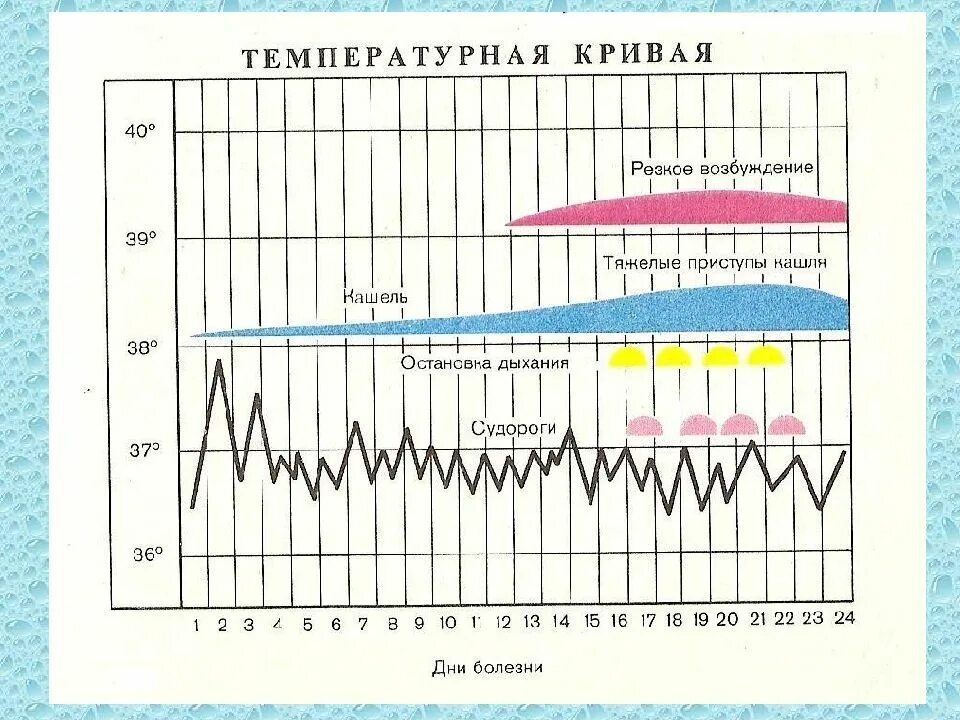 Коклюш график. Температурная кривая. Температурная кривая при кори. Тип температурной Кривой при гриппе. Температурный лист ребенка.