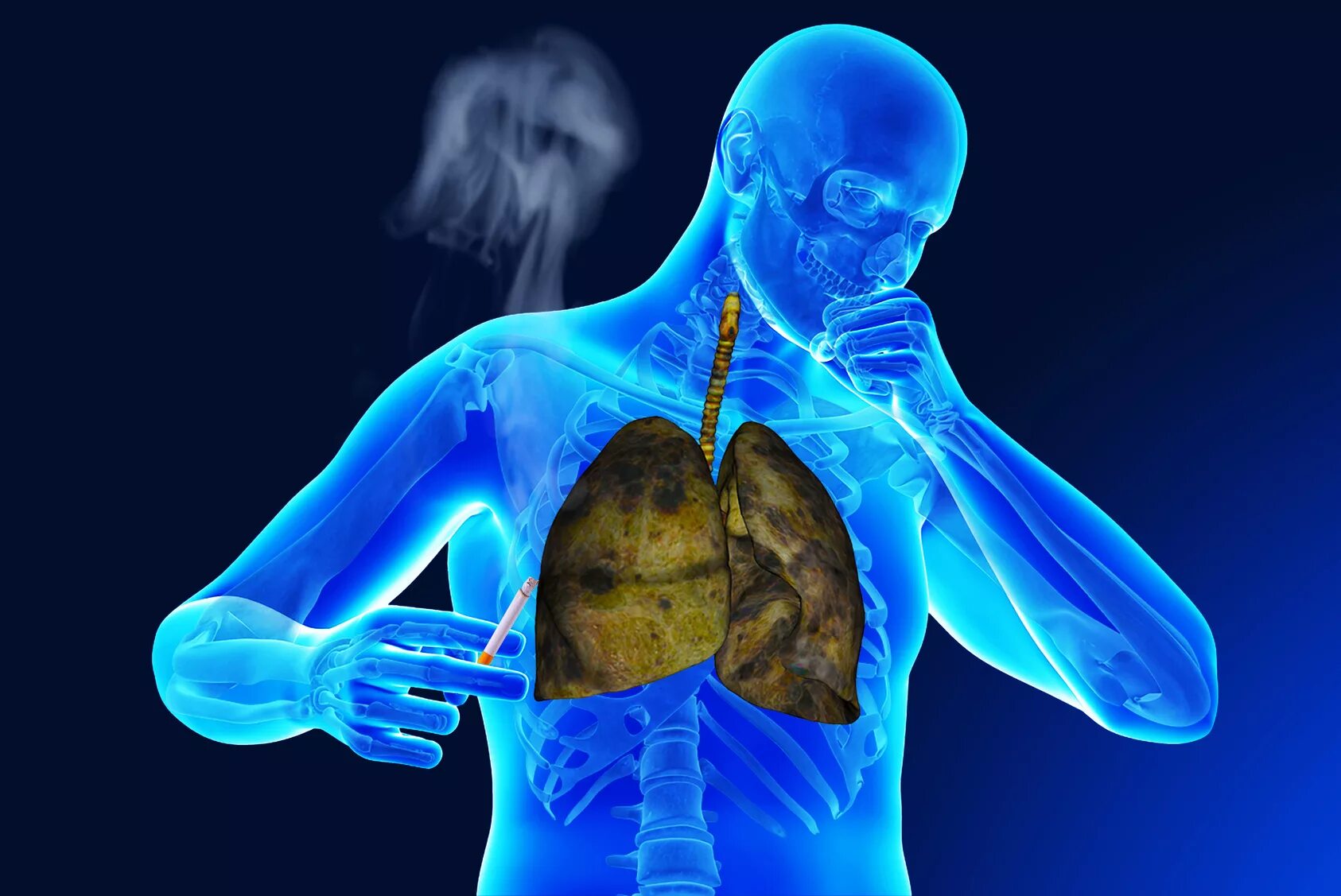 Хронические респираторные заболевания. Заболевания органов дыхания. Патологии дыхательной системы.