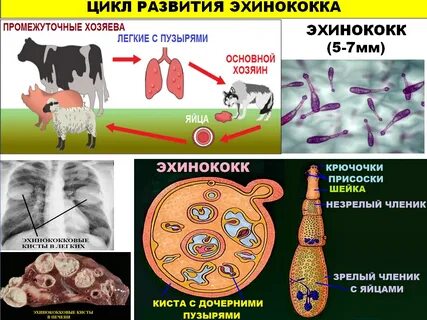 Аскаридоз и эхинококкоз