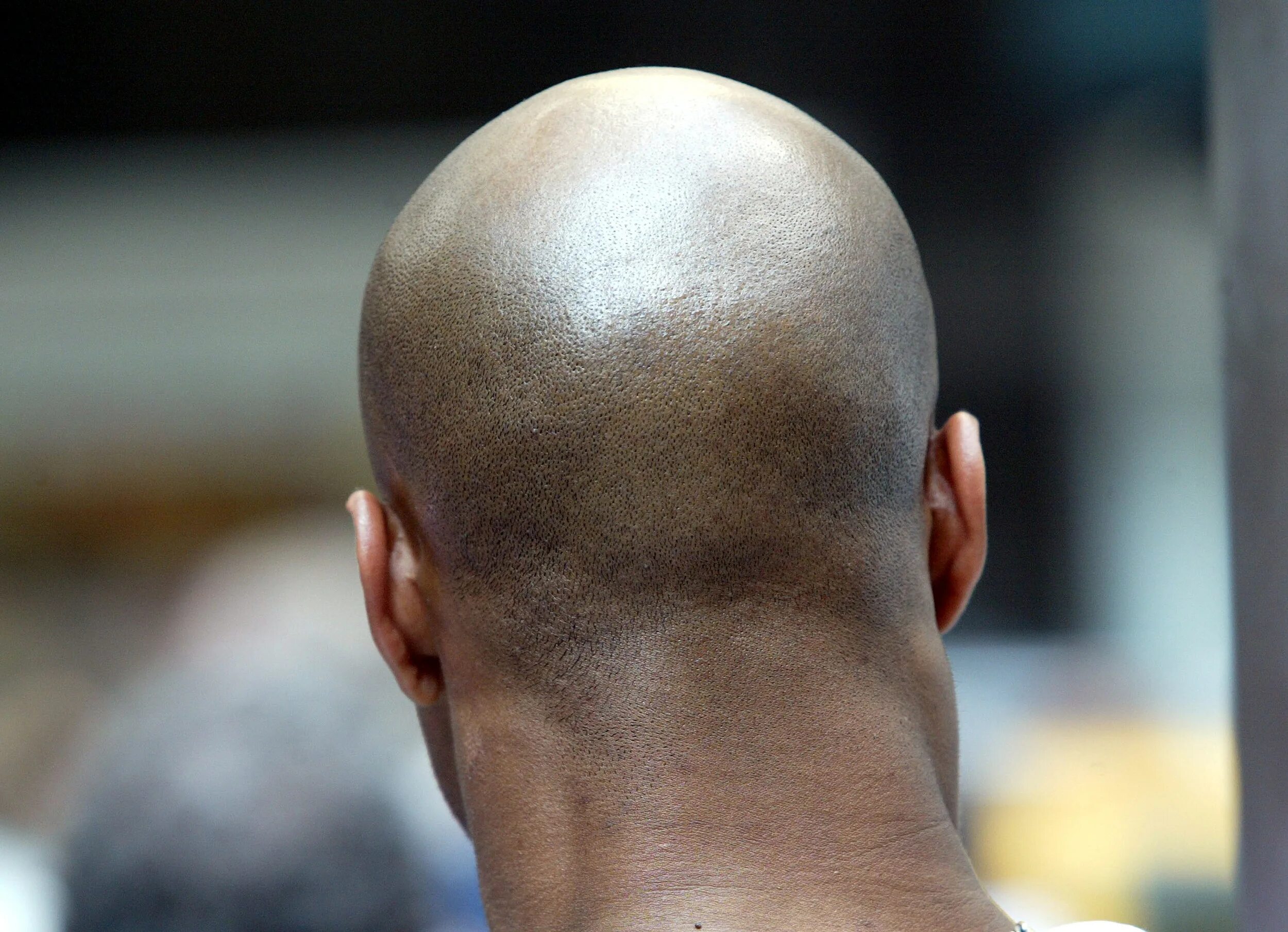 как сделать лысину. как сделать лысину. как сделать лысину. как сделать лысину. лысая мужская голова.