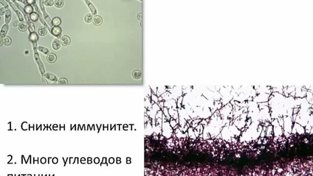 Микроскопия аспергилл. Кандида альбиканс на коже. Candida ниже пз. Penicillium notatum пенициллин. Trichophyton mentagrophytes.