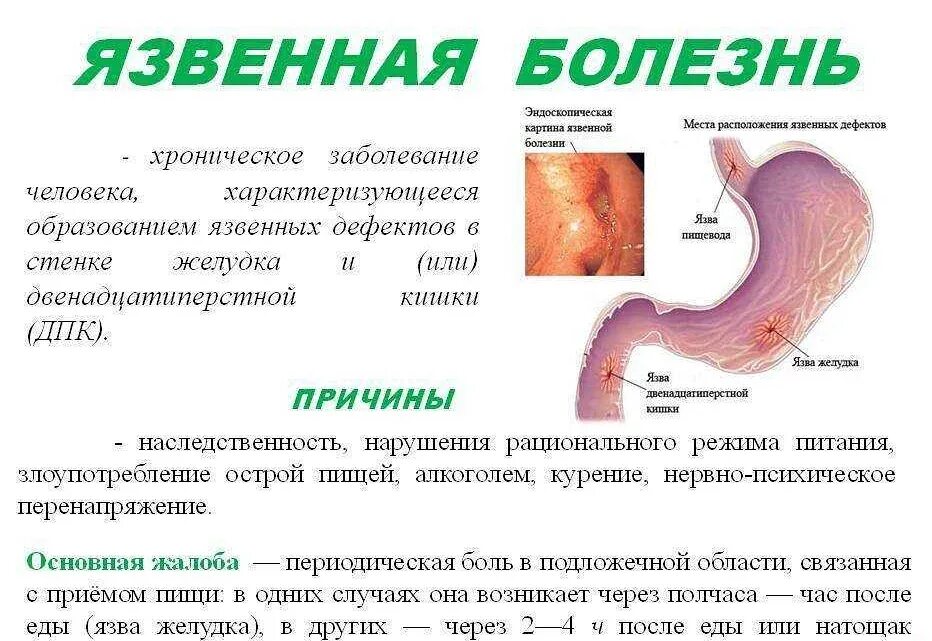 Язвенная болезнь желудка и 12 перстной. Обострение язвенной болезни желудка и 12-перстной кишки.. Жалобы при язвенной болезни желудка и 12-перстной кишки. Причины заболевания язвенной болезни желудка. Язва симптомы и лечение у взрослых