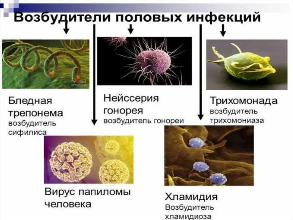 Инфекции передаваемые пол путем возбудитель инфекции. Возбудители инфекционных заболеваний передаваемые половым. Возбудители болезней вирусы и бактерии. Возбудители заболеваний передающихся половым путем: гонорея.