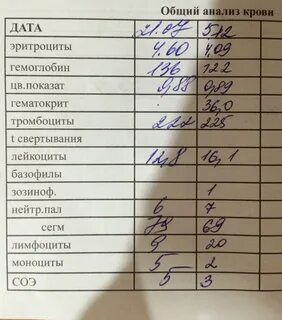 Анализв