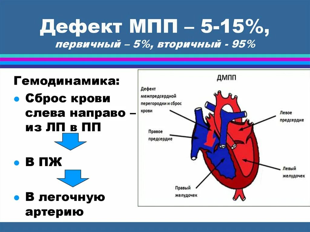 Дмпп это. Дмпп это