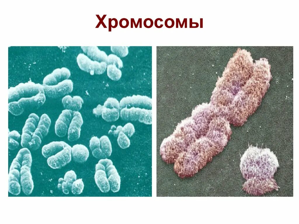 Вторая х хромосома. Хромосомы человека. Как выглядит хромосома человека. Хромосомные человека.
