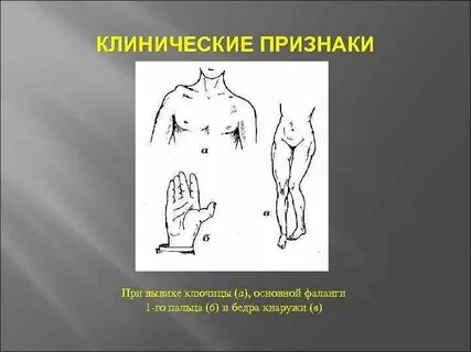 Симптомы ключицы