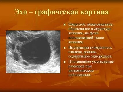 Образование яичника с четкими ровными контурами
