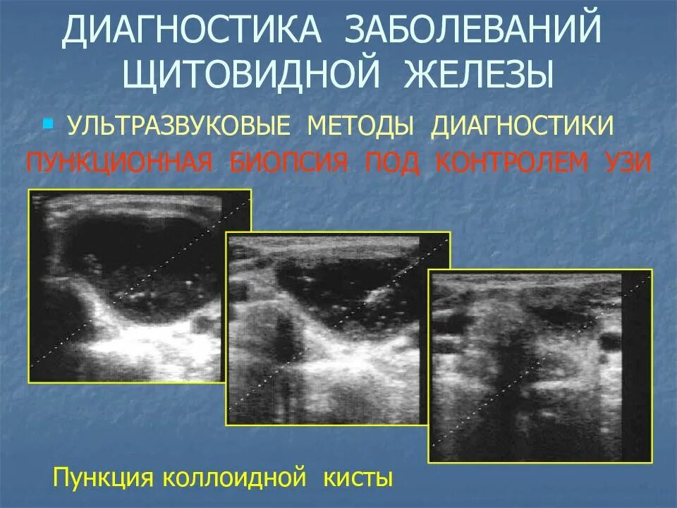 Диффузные узлы