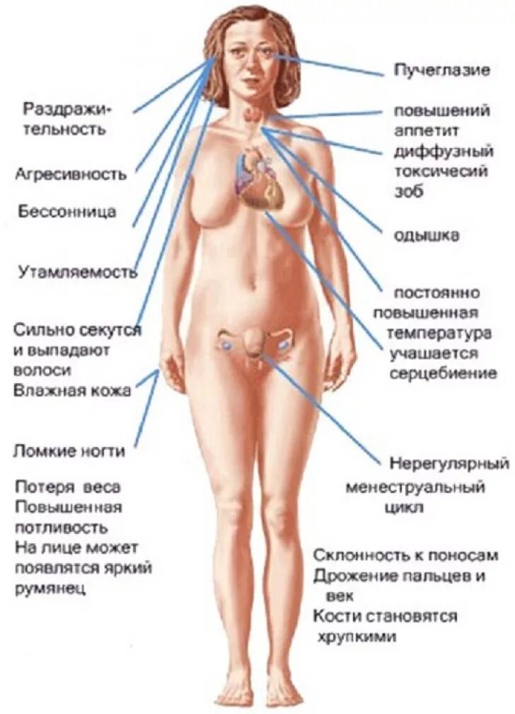 При гипертиреозе можно принимать. Щитовидная железа симптомы заболевания гипотиреоз. Болезнь щитовидной железы гипотиреоз. Гиперфункция щитовидной железы симптомы. Болезнь гипотиреоз щитовидной железы симптомы.