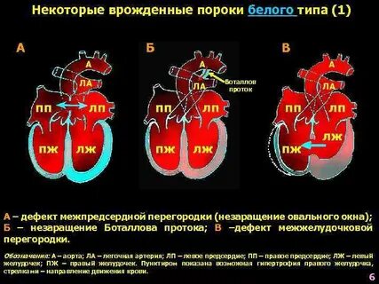 Сколько живут с врожденным пороком
