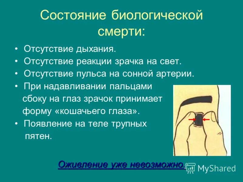 Отсутствие реакции зрачка на свет признак отсутствия. Биологическая смерть пульс. Признаки биологической смерти отсутствие дыхания. Состояние сердцебиения при биологической смерти. Биологическая смерть дыхание.