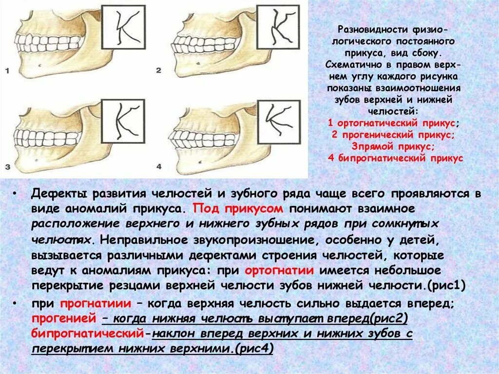 Ортогнатический прикус постановка зубов. Типы нарушений прикуса. Нормальный физиологический прикус. Характеристика прикуса.