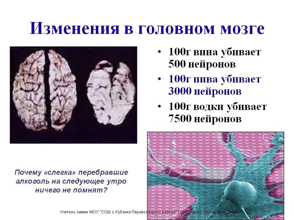 Структурные изменения в мозге