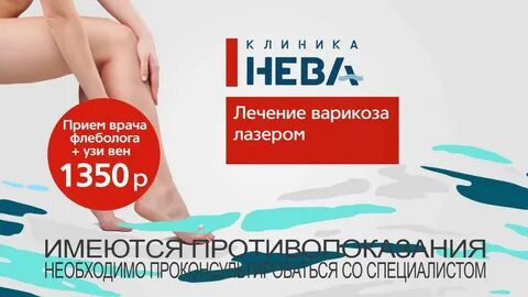 Варикоза нет киров