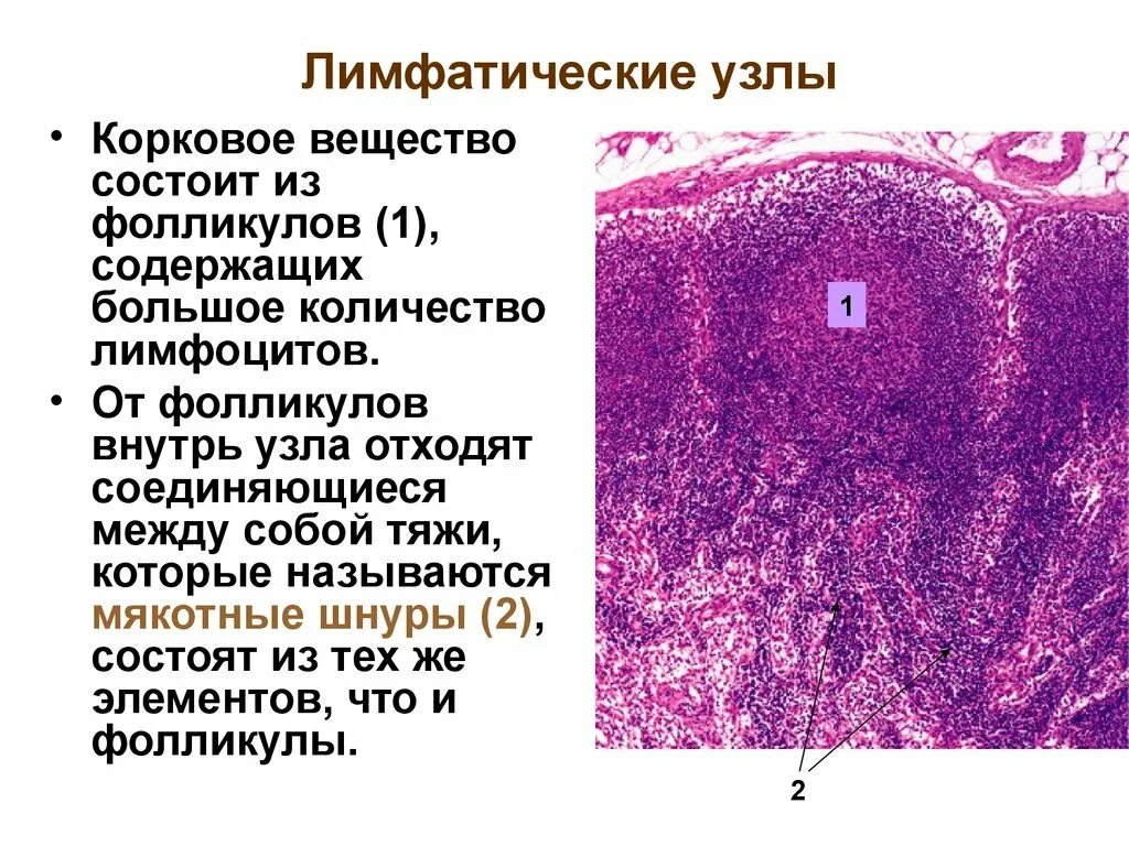 Лимфатический узел гистология препарат. Лимфоидный узел гистология. Строение лимфатического узла гистология. Мякотные шнуры лимфатического узла. В селезенке образуются клетки