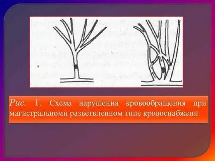 Схема нарушения