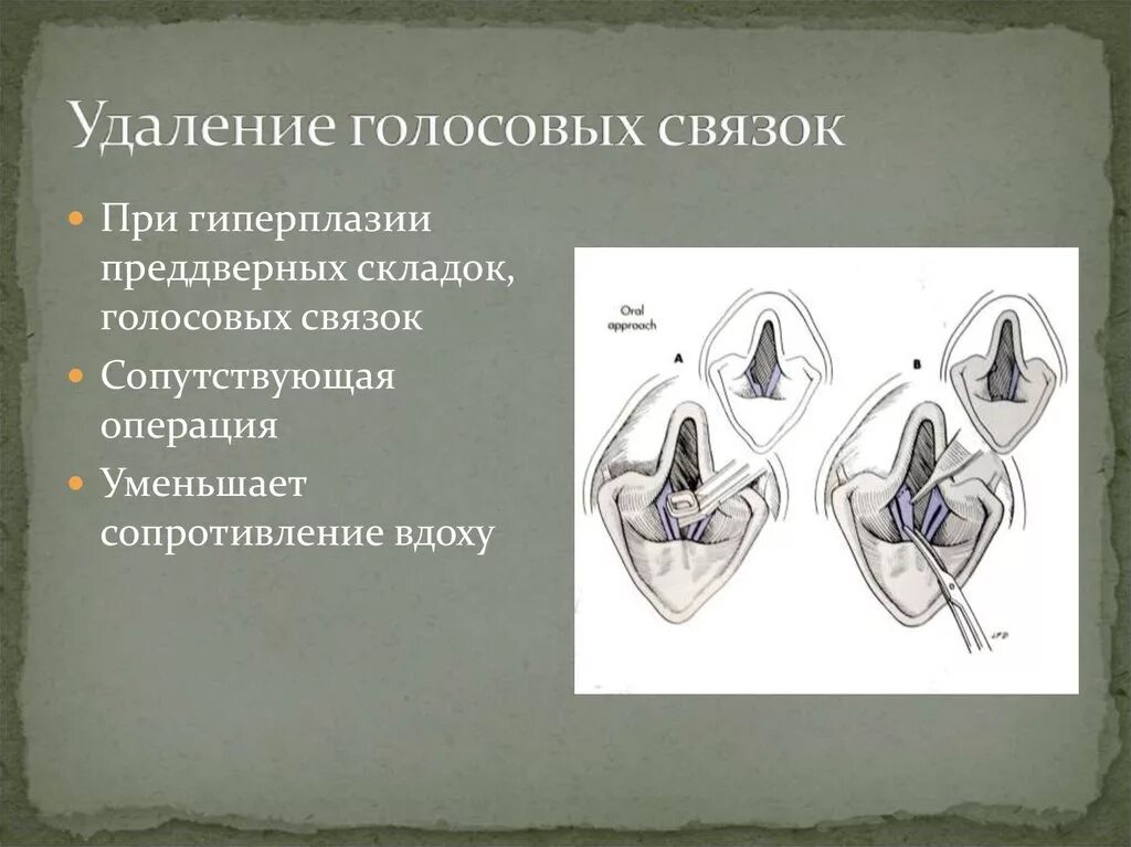 Можно голосовой. Голосовые связки у собак. Отрезание голосовыхсвязок. Удаление голосовых связок. Подрезание голосовых связок.