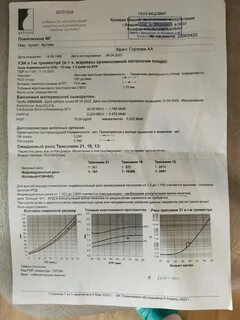 Трисомия 21 18 13