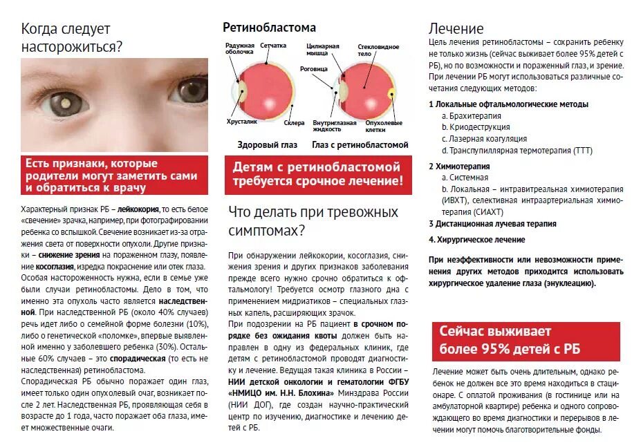 Опухоли детского возраста. Онкология глаза симптомы. Ранний симптом ретинобластомы у детей. Болезни глаз и онкология. Первые признаки крови у детей