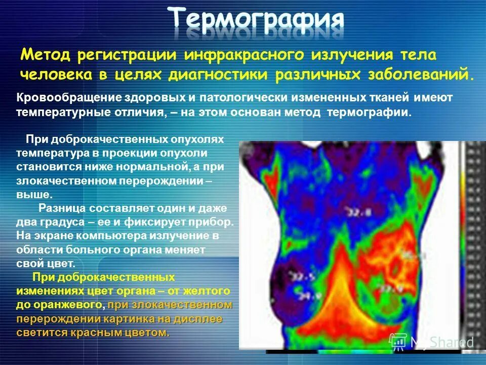 инфракрасная лампа corall-2000. массажер коралл-2000 psa-232. аппарат коралл 2000. инфракрасная термография. терра герцевое излучение.