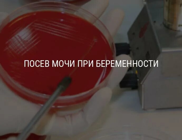 Как правильно сдать бак. Посев мочи. Моча на посев. Бак посев мочи на стерильность. Сбор мочи для посева на микрофлору.