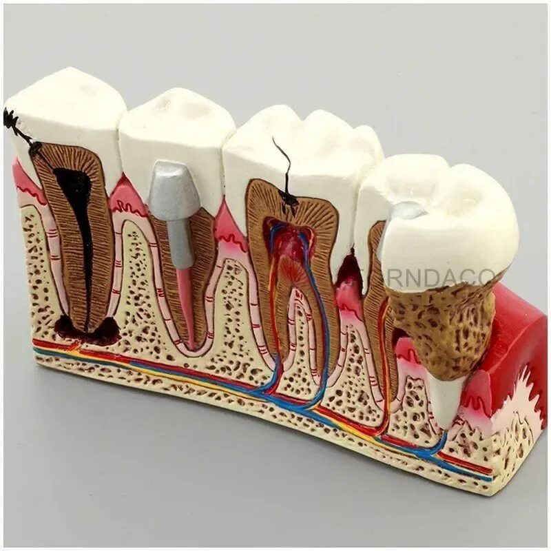 Модель полости рта. Муляж зубов. Модель зуба. Макет зубов.