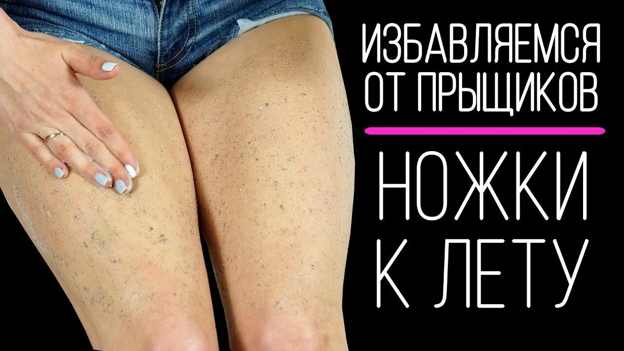 Ляшки лечить. Прыщи на ягодицах и ляжках.