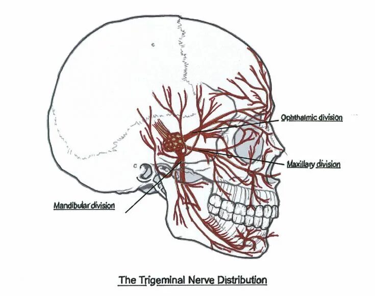 Neuralgia латынь. Trigeminal euralgiya. trigeminal nerve. trigeminal neuralgia open surgery.