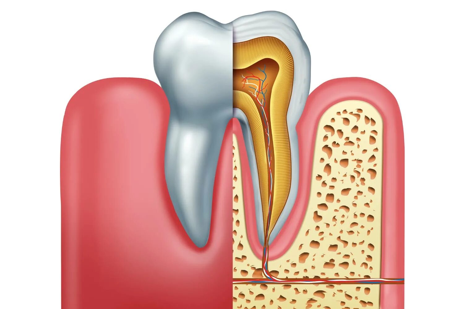 Root canal