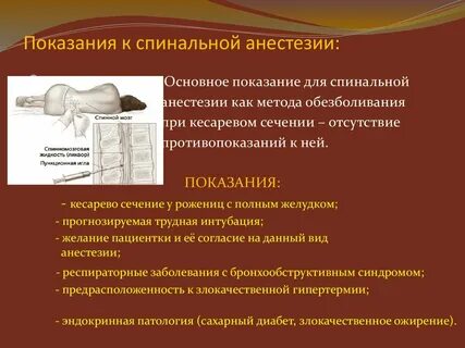 Спинальная анестезия