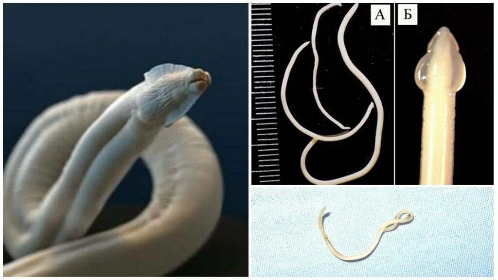 гермафродитизм размножение. гермафродитизм у паразитических червей. гермафродитизм у червей. дождевой червь гермафродит. беспозвоночные черви представители.