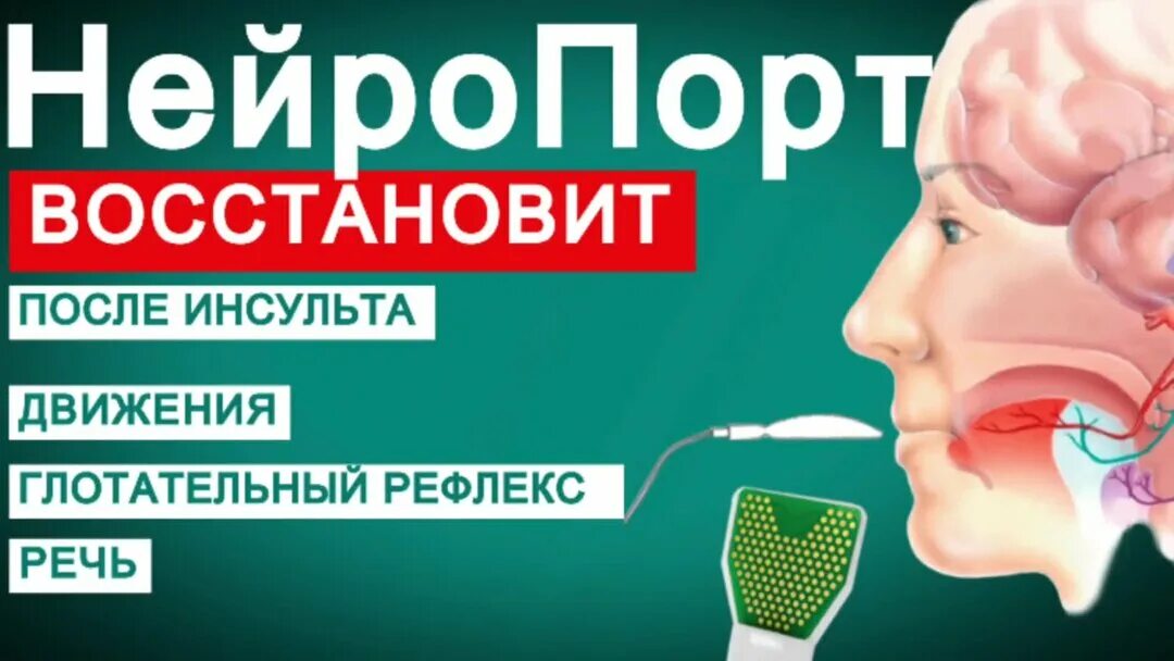 Нейропорт. Прибор Нейропорт. Нейропорт отзывы после инсульта. Транслингвальная нейростимуляция. Нейропорт купить