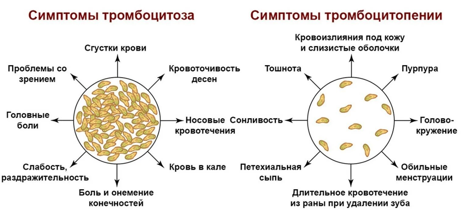 Лечение тромбоцитопении у взрослых. Тромбоцитоз. Тромбоцитоз симптомы. Признаки тромбоцитоза. Тромбоцитоз причины.