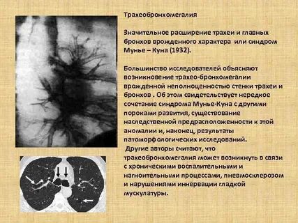 Значительное расширение