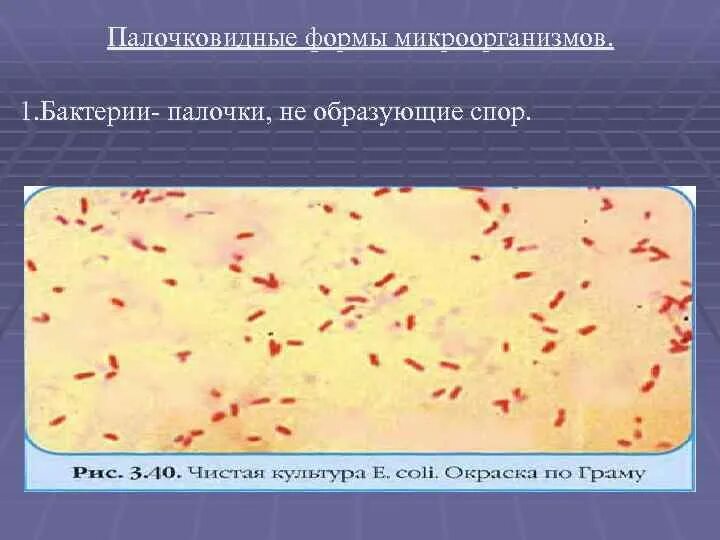 Микроорганизмы образующие споры. Бактерии в форме палочки. Палочковидные формы микроорганизмов. Палочковидные бактерии образующие споры. Палочковидные формы бактерий.