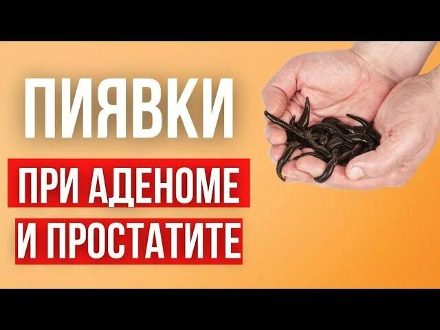 Пиявки при простатите