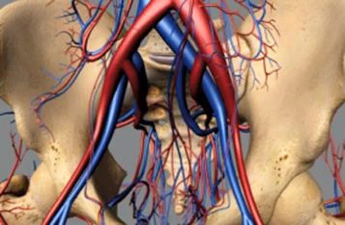 Сосуды малого таза артерии и вены. Артерии кровоснабжающие полость малого таза. Подвздошная артерия варикоз. Сосуды малого таза. Наружная подвздошная артерия нижняя надчревная артерия.