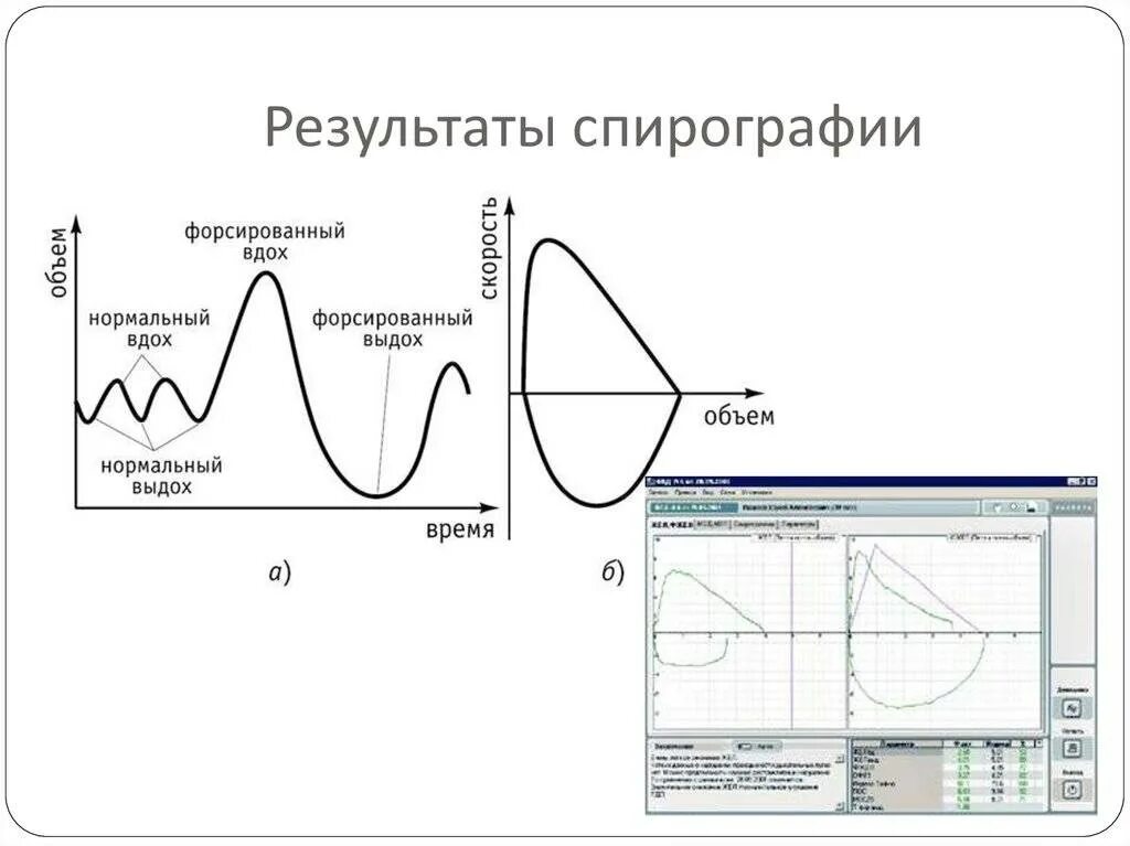 Данные спирографии