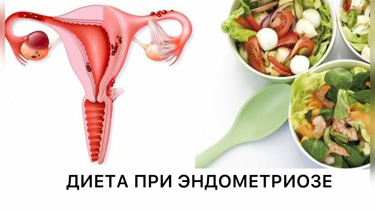 Что можно есть после операции матки. Питание при онкологии шейки матки. эндометриозе диета. питание при эндометриозе матки.