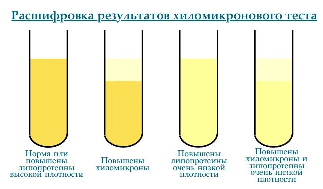 Какого цвета должна быть моча у мужчин. В норме цвет сыворотки/плазмы крови. Хилёзная сыворотка крови что это. Цвет сыворотки крови в норме.