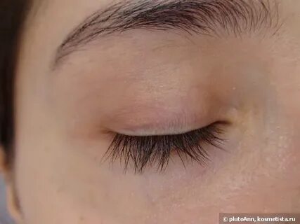Ресницы стали редкими и короткими