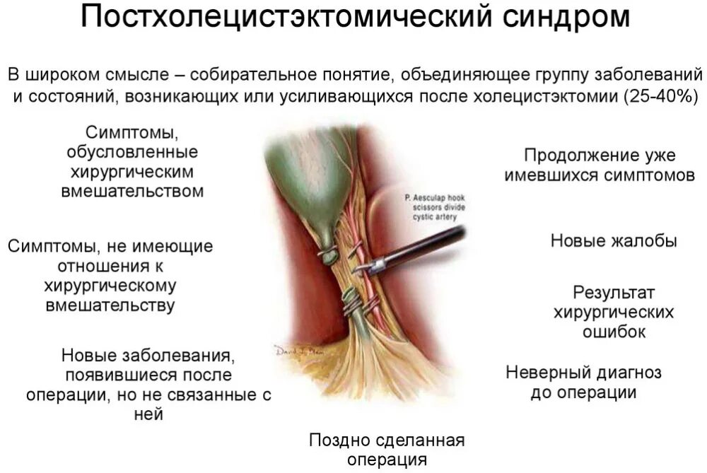 Болит после операции желчный пузырь