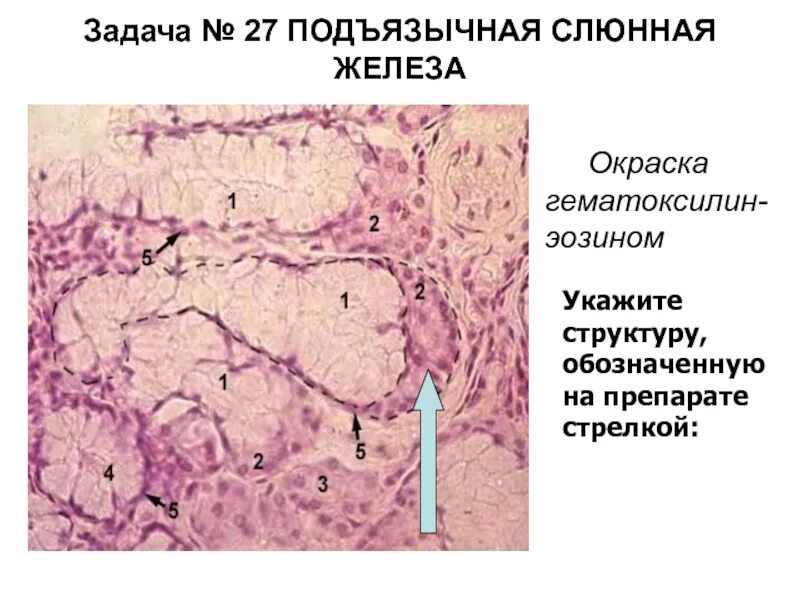 Препарат околоушной железы. Поднижнечелюстная железа гистология. Подчелюстная слюнная железа гистология. Поднижнечелюстная слюнная железа гистология. Околоушная слюнная железа гистология.