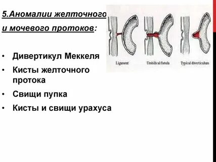 Желточного протока