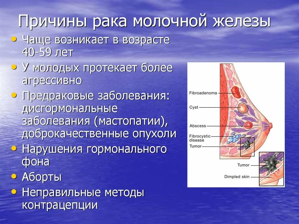 Почему бывает рак. Заболевания молочных желез. Патологии в молочной железе. Локализация опухоли молочной железы. Заболевания молочной железы у женщин.