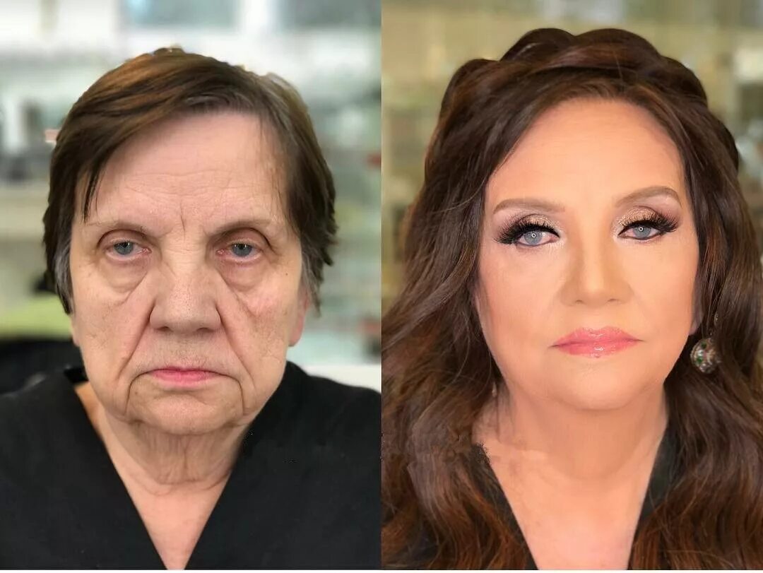 Омоложение женщины после 50 лет